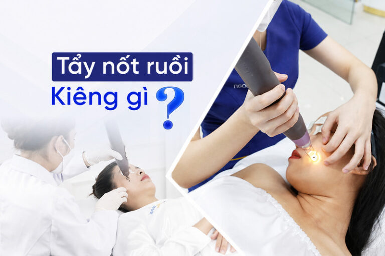 Tẩy nốt ruồi kiêng gì? Hướng dẫn chăm sóc da nhanh lành an toàn
